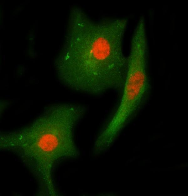  IF analysis of CHEK2 using anti-CHEK2 antibody (A00277-2) and anti-Beta Tubulin antibody (M01857-3)
