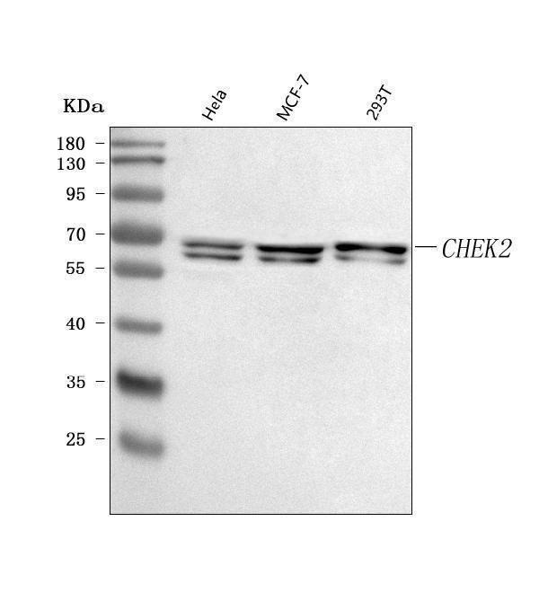  Western blot analysis of CHEK2 using anti-CHEK2 antibody (A00277-2)