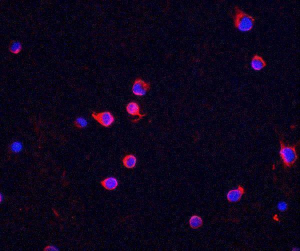 a00277 chek2 primary antibodies if testing 3