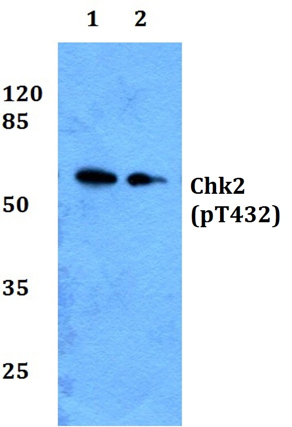 Western blot (WB) analysis of p-Chk2 (T432) polyclonal antibody at 1:500 dilution
Lane1:Jurkat whole cell lysate
Lane2:H9C2 whole cell lysate