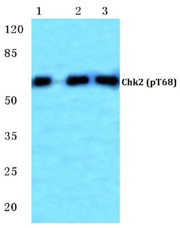 Western blot (WB) analysis of p-Chk2 (T68) polyclonal antibody at 1:500 dilution
Lane1:MCF-7 cell lysate treated with UV
Lane2:Mouse kidney tissue lysate
Lane3:H9C2 cell lysate treated with UV