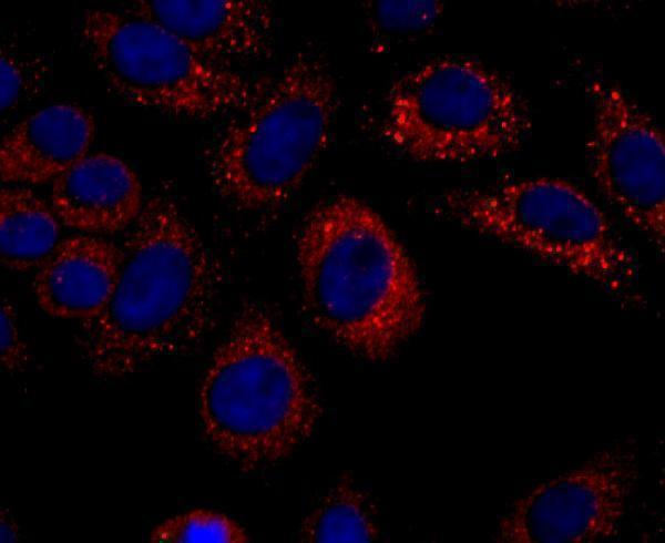 ICC staining IP10 in HepG2 cells (red)