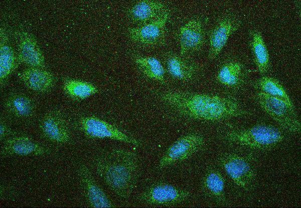 a00279 2 nf2 primary antibodies if testing 6
