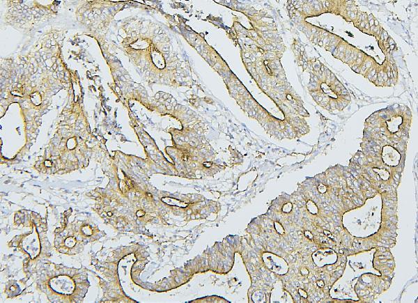 a00279 2 nf2 primary antibodies ihc testing 3_1