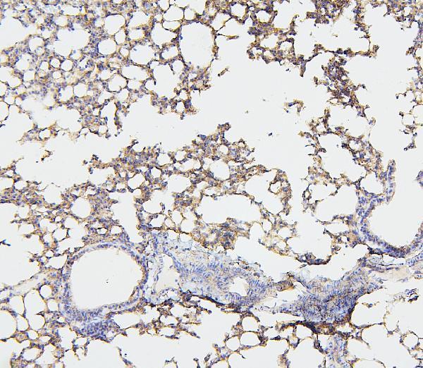 a00279 2 nf2 primary antibodies ihc testing 4