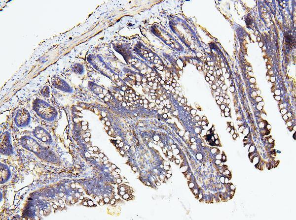 a00279 2 nf2 primary antibodies ihc testing 5