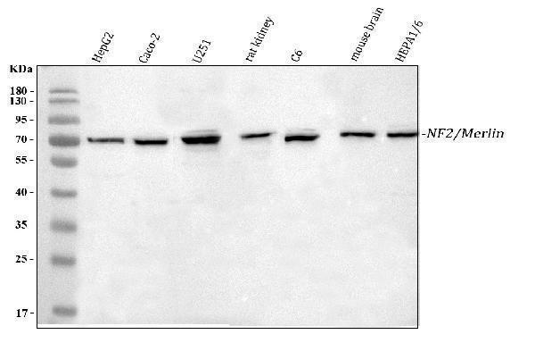 a00279 2 nf2 primary antibodies wb testing 1