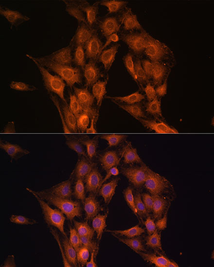 a00279 nf2 primary antiboties if testing 3