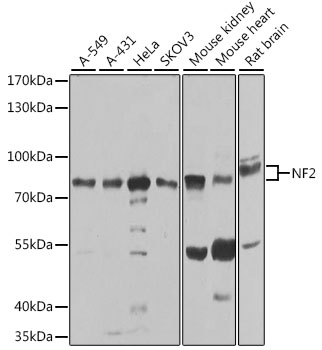 a00279 nf2 primary antiboties wb testing 1