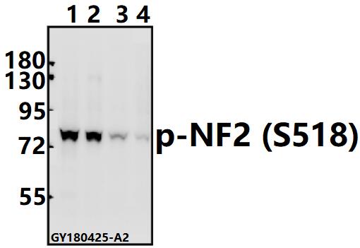 Western blot (WB) analysis of p-NF2 (S518) pAb at 1:500 dilution
Lane1:A375 whole cell lysate(40ug)
Lane2:Hela whole cell lysate(40ug)
Lane3:The Uterus tissue lysate of Rat(40ug)
Lane4:CT26 whole cell lysate(40ug)