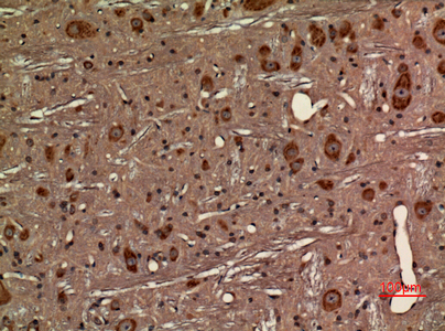 Immunohistochemical analysis of paraffin-embedded rat-brain, antibody was diluted at 1:100