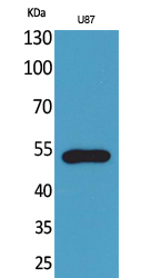 Western Blot analysis of U87 cells using Fractalkine Receptor Polyclonal Antibody