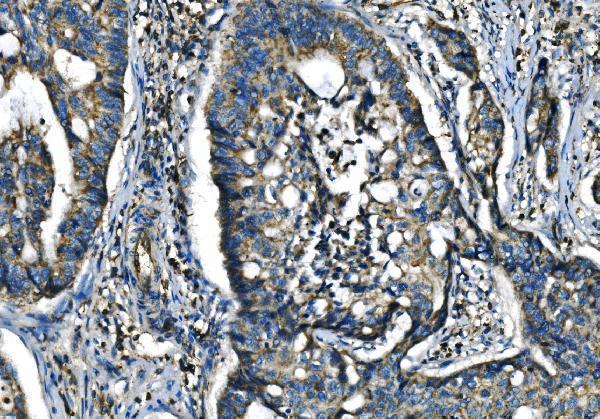  IHC analysis of CX3CR1 using anti-CX3CR1 antibody (A00280-2)
