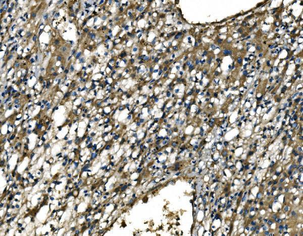  IHC analysis of CX3CR1 using anti-CX3CR1 antibody (A00280-2)