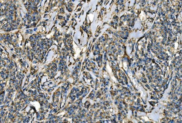  IHC analysis of CX3CR1 using anti-CX3CR1 antibody (A00280-2)