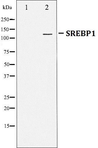 Western blot analysis of SREBP-1 expression in TNF treated JK cell lysates,The lane on the left is treated with the antigen-specific peptide