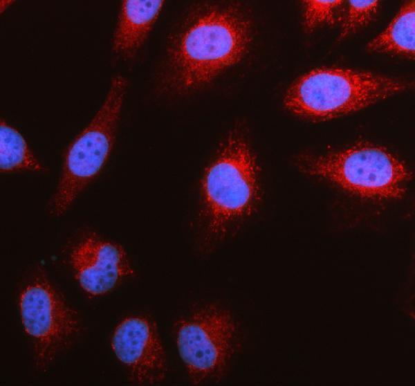 IF analysis of SREBF1 using anti-SREBF1 antibody (A00282-2)