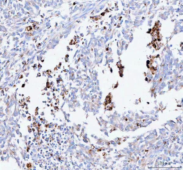  IHC analysis of SREBF1 using anti-SREBF1 antibody (A00282-2)
