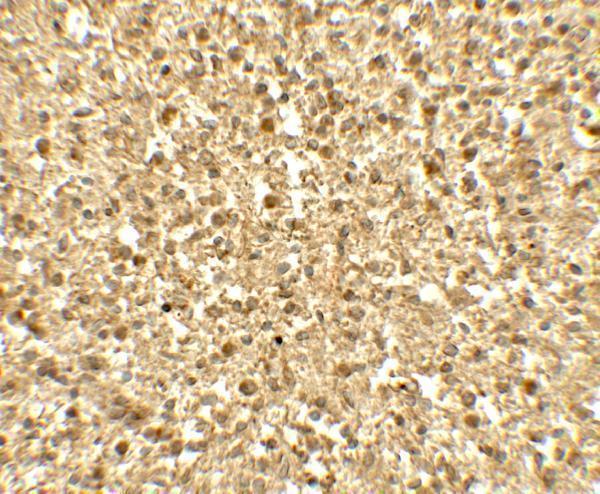 Immunohistochemistry of SREBF1 in human spleen tissue with SREBF1 antibody at 5 μg/mL