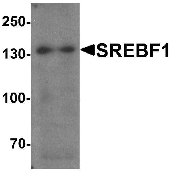 Western blot analysis of SREBF1 in Daudi cell lysate with SREBF1 antibody at 1 μg/ml