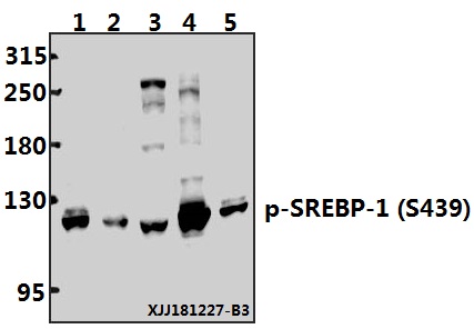 Western blot (WB) analysis of SREBP-1 (phospho-S439) polyclonal antibody at 1:500 dilution
Lane1:Myla2059 whole cell lysate(40ug)
Lane2:RAW264