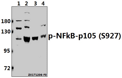 Western blot (WB) analysis of p-NFkB-p105 (S927) pAb at 1:500 dilution
Lane1:SGC7901 whole cell lysate(40ug)
Lane2:Hela whole cell lysate(40ug)
Lane3:The Spleen tissue lysate of Rat(40ug)
Lane4:The Testis tissue lysate of Mouse(40ug)