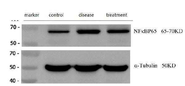 a00284 1 rela primary antibodies wb review 1