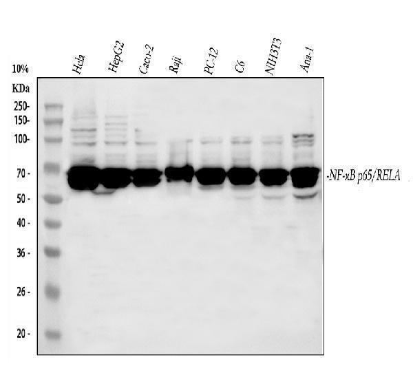  Western blot analysis of NF-ΚB P6/RELA using anti-NF-ΚB P6/RELA antibody (A00284-4)