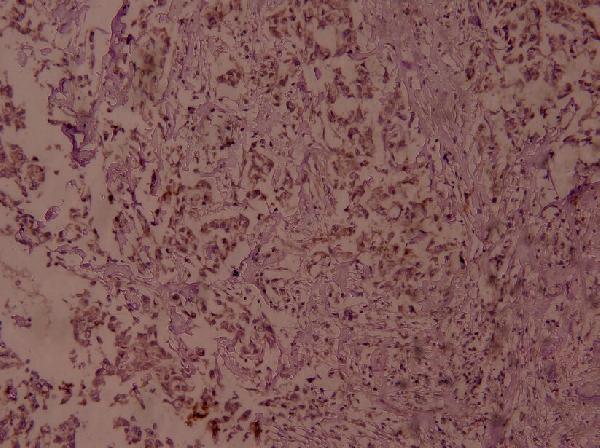 a00284s468 1 rela primary antiboties ihc testing 2