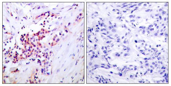 a00284s468 2 rela primary antibodies ihc testing 1