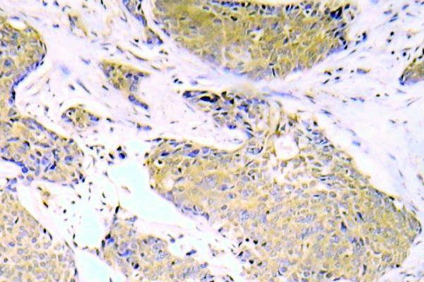 a00284s536 1 rela primary antiboties ihc testing 2