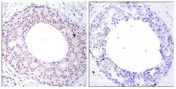 a00284t254 rela primary antibodies ihc testing 1