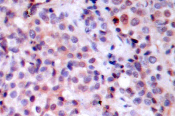 a00284t429 rela primary antiboties ihc testing 2