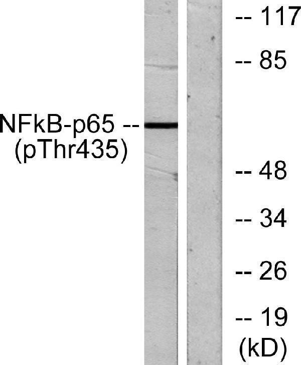 a00284t435 1 rela primary antibodies wb testing 2