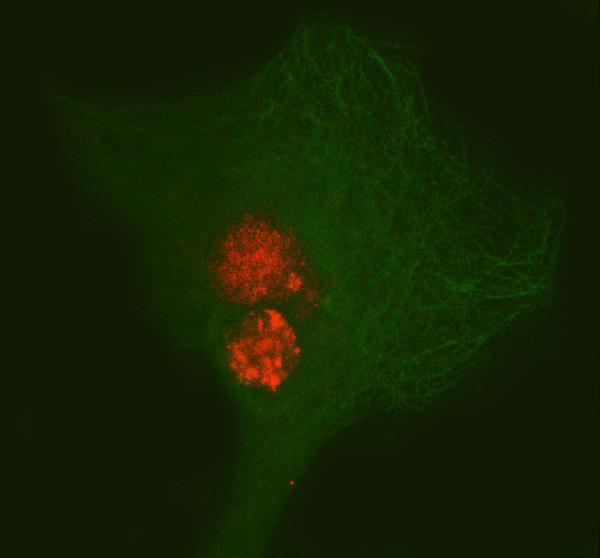  IF analysis of PAX3 using anti-PAX3 antibody (A00285-2) and anti-Beta Tubulin antibody (M01857-3)