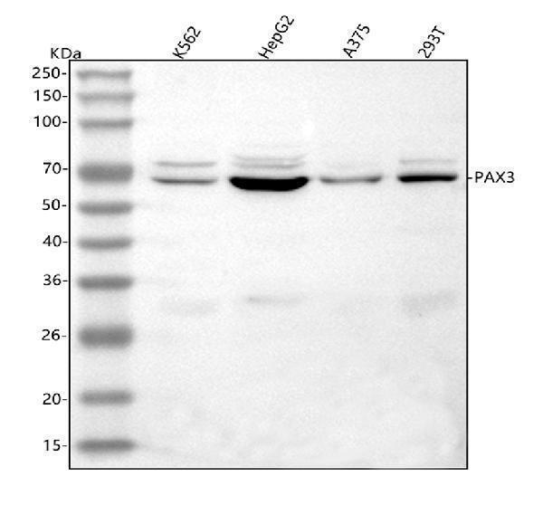 Western blot analysis of PAX3 using anti-PAX3 antibody (A00285-2)