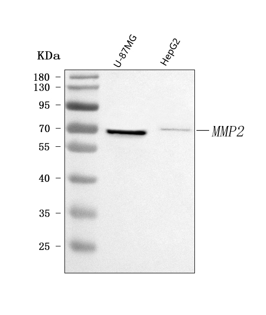  Western blot analysis of MMP2 using anti-MMP2 antibody (A00286-3)