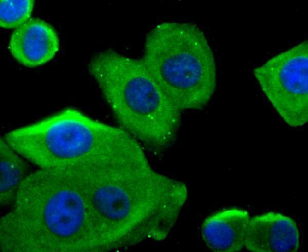 ICC staining Glucose 6 Phosphate Dehydrogenase in MCF-7 cells (green)