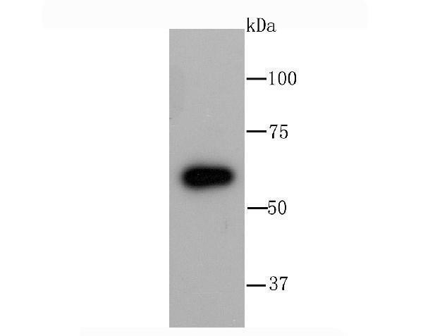 Western blot analysis of Glucose 6 Phosphate Dehydrogenase on A549 cell lysate using anti-Glucose 6 Phosphate Dehydrogenase antibody at 1/1,000 dilution