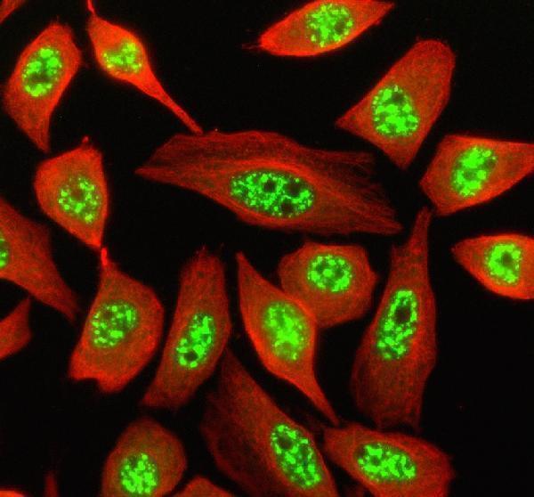 a00288 1 son primary antibodies if testing 2