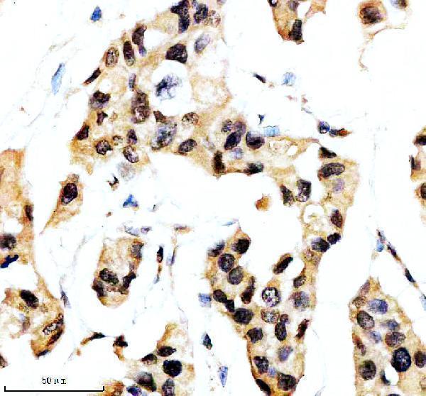 a00288 1 son primary antibodies ihc testing 1