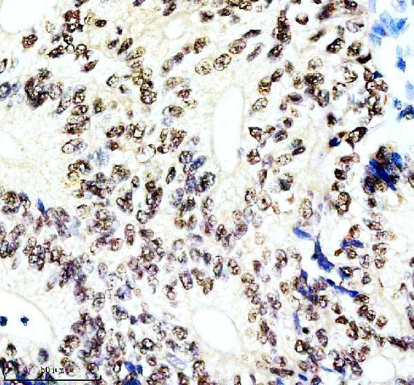 a00288 1 son primary antibodies ihc testing 2