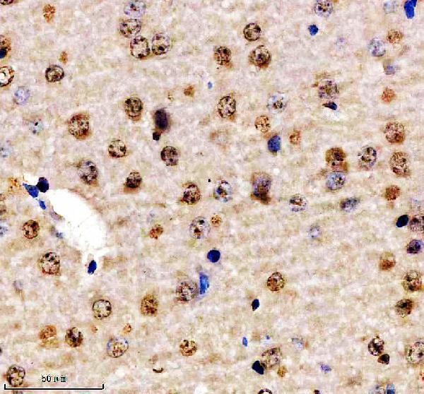 a00288 1 son primary antibodies ihc testing 3