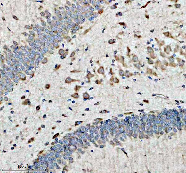 IHC analysis of DRD2 using anti-DRD2 antibody (A00289-1)