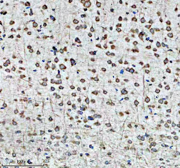IHC analysis of DRD2 using anti-DRD2 antibody (A00289-1)