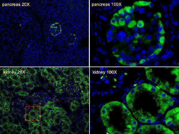 a00290 anti ttr antibody c term if testing 1
