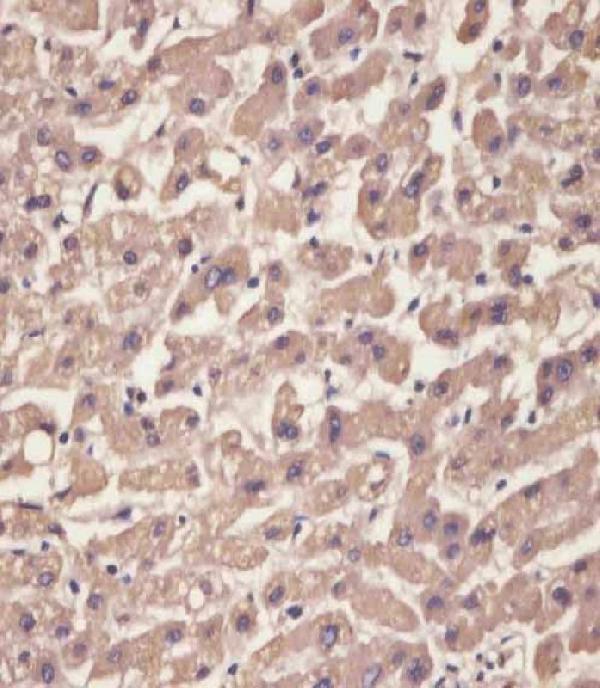 a00290 anti ttr antibody c term ihc p testing 3
