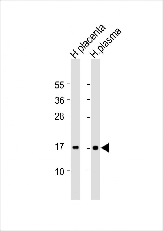a00290 anti ttr antibody c term wb testing 2