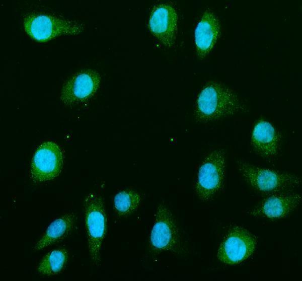 a00292 map2k1 primary antibodies if testing 3