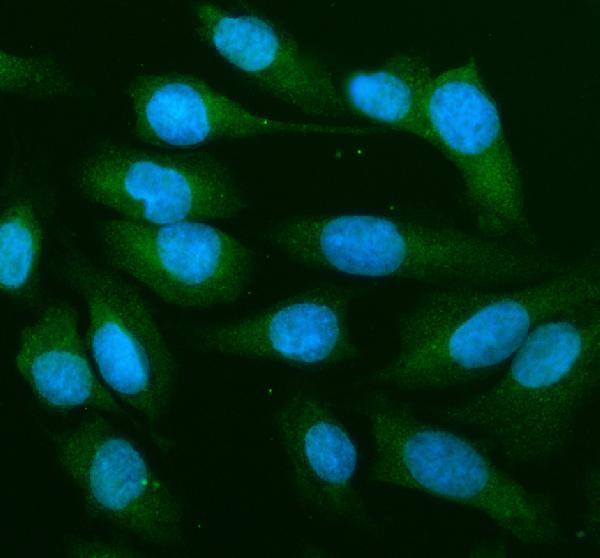 a00292 map2k1 primary antibodies if testing 4